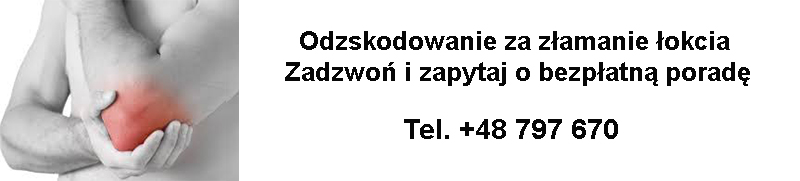 Złamanie łokcia i odszkodowanie po wypadku komunikacyjnym. Dlaczego powinieneś zwrócić się o pomoc do Naszej Kancelarii?